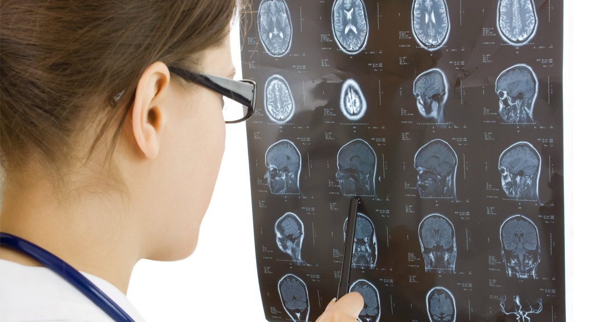 The Relationship Between Traumatic Brain Injuries and Car Accidents